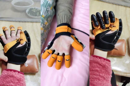 Soft robotic hand rehabilitation glove worn on a patient’s hand, designed for stroke recovery and post-surgery therapy at home.