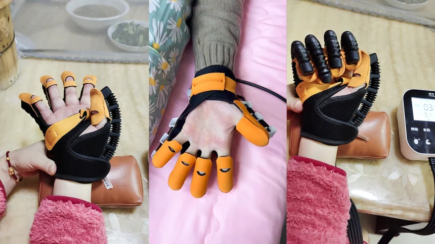 Soft robotic hand rehabilitation glove worn on a patient’s hand, designed for stroke recovery and post-surgery therapy at home.